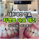 따뜻한치과병원 | 대구 수성구 치과 치경부 마모 레진 GI 내 돈 내산 후기