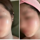 에이치-테라피 이미지