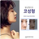 별성형외과