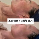 단(체력단련장업) | 천안 슈퍼젝션 12회차 진행하기 까지의 모든 과정 리얼 후기