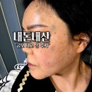 라마르의원 | 울산 리쥬란 쥬베룩 후기｜울산 삼산동 피부과 필러 보톡스 내돈내산