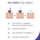 하우치아