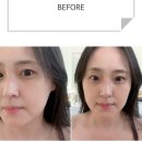 남동53 | 인천 남동구 만수동 피부관리 잘 하는 곳 / 미소샵 피부관리 후기