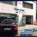 덴트존 이미지
