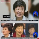 '세월호 7시간' 박근혜 대통령 성형수술 의혹…전문의 견해 보니 "상안검·하안검·미스코 했다" 이미지