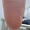 네일매끈 Nail The Sleek | 의정부발각질 제거로 매끈한 발바닥 찾은 후기 녹양동 더케어 네일앤스파