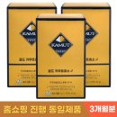 그레인 이미지