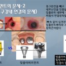 동그라미 치과기공소 이미지