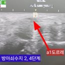 수지2 이미지