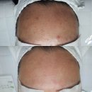 모아드 네이버블로그