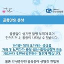 뼈에도 종양이 생긴다고요? &#39;골종양&#39;﻿ 이미지