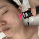 인천대입구역 2번출구 | 송도피부관리 살롱드신데렐라에서 받은 피부진단부터 레이저까지 솔직후기