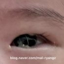 정상기안과의원 이미지