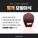 바로서면병원 | 서면 탈모병원추천 진짜 후기처럼 믿을 만한 곳 고르는 법
