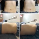 산후다이어트 잘하기로 소문난 곳 : 리타임뷰티 가산점에서 웰바디다이어트 프로그램 받고 온 후기