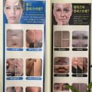 대구콜드플라즈마 대구잡티주근깨제거 플라즈마블라스트 지아뷰티 물광피부관리 닥토필 후기