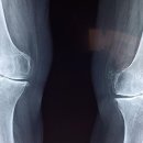 부흥환경 이미지