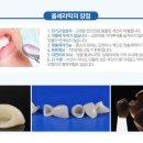 올크라운