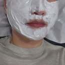 리얼타겟 | 신논현피부과 울트라펄스알파 여드름흉터시술 1회차 후기 통증 치료과정 결과 리얼 후기