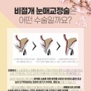 선명 이미지