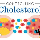 메디휴엔 이미지