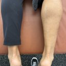 Higher LAB(하이어랩) | 진주전지훈련 : 코오롱 이정국 마라톤 선수 아킬레스건 통증/증상 재활운동 후기.