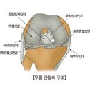 퇴행성관절염 이미지