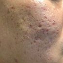 오름한의원 이미지