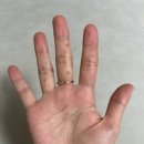 세종김연수피부과의원 네이버블로그