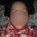 바이슈의원 | 써마지flx600샷 시술후기 입니동ㅎ