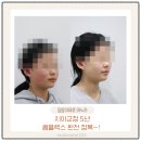 슈어치과교정과치과병원 | 영종도 하늘도시 치아교정 치과추천(내돈내산)비용,기간,시기