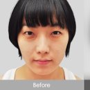 리젠메디 이미지