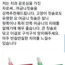 어금니칫솔 (첨단칫솔) 이미지