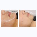 소답동165 | (창원왁싱) 턱수염&amp;인중왁싱 안아프게 잘뽑는 창원금손언니왁싱한번 와보세요😉