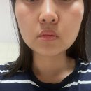 [광주] 윤곽관리,웨딩관리,피부관리 잘하는곳 “수아벨라 에스테틱” 리얼후기