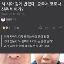 혀·치아 검게 변했다…중국서 코로나 신종 변이가? 이미지