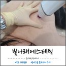 인천 송도 플라즈마 후기, 빛나래에스테틱 등여드름 케어 리얼후기