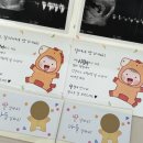 봄약국 | [임신기록] 초기~20주 / 검단더나아산부인과 / 태아보험 / 젠더리빌 / 임산부코드 / 이대서울병원