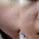 세종인셀덤 대전인셀덤 유투버 강유미 세안제추천 연예인화장품 클린업파우더 인셀덤세안제로 각질제거 끝