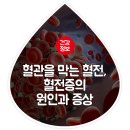 혈관을 막는 시한폭탄 혈전,혈전증의 원인과 증상 이미지