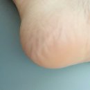 (주)케어풋솔루션 이미지