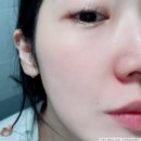 여드름성피부 순한화장품, 닥터505 에이플러스 3스텝 솔루션 (폼, 토너, 로션) 후기
