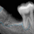 호평나무치과의원 이미지