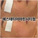 리젠에스테틱 - 김해시 | 해운대피부관리 에스테틱 후기 - 에스테티아 마린시티점에서 받은 섬세한 관리더마리젠리턴솔루션후기