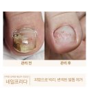 프리다네일
