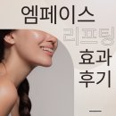 청담피부과 엠페이스 리프팅 효과 주기 한달 후기