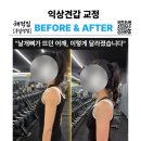 구일역 | 구일역 PT 익상견갑 교정 후기, 날개뼈 들림 현상 개선 전후 변화