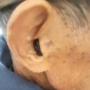 부안보청기 이미지