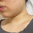 고려리프트 | 내돈내산 [홈모드써마리프트] 바디모드 6주차후기