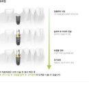 UIC시카고치과